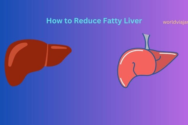 Fatty liver foods