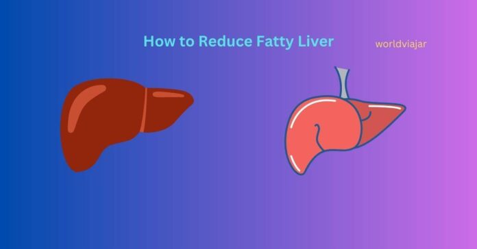 Fatty liver foods